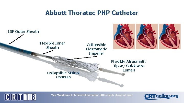 Abbott Thoratec PHP Catheter 13 F Outer Sheath Flexible Inner Sheath Collapsible Nitinol Cannula Abbott Thoratec PHP Catheter 13 F Outer Sheath Flexible Inner Sheath Collapsible Nitinol Cannula
