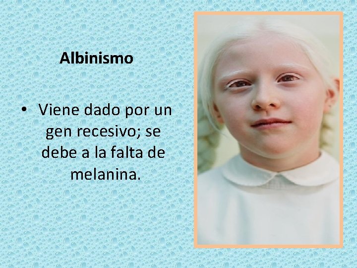 Albinismo • Viene dado por un gen recesivo; se debe a la falta de