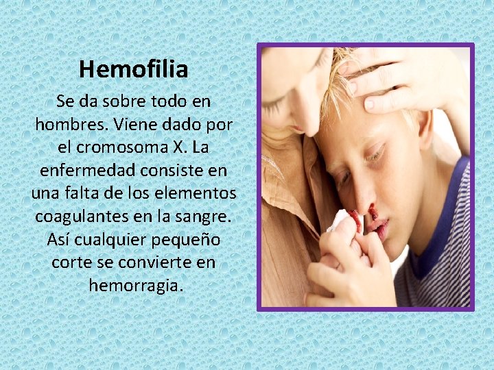 Hemofilia Se da sobre todo en hombres. Viene dado por el cromosoma X. La