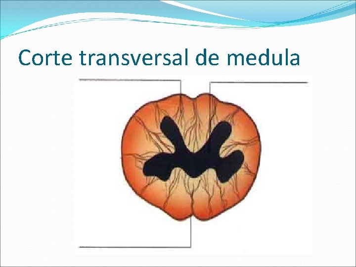 Corte transversal de medula 