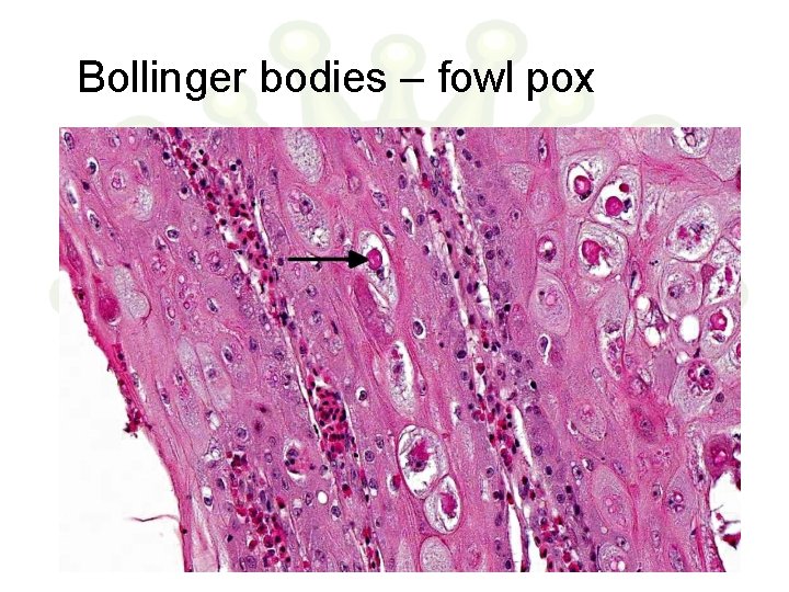 Bollinger bodies – fowl pox 