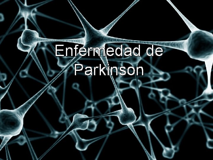 Enfermedad de Parkinson 