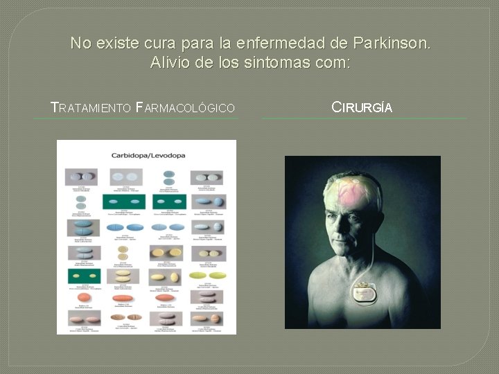 No existe cura para la enfermedad de Parkinson. Alivio de los sintomas com: TRATAMIENTO