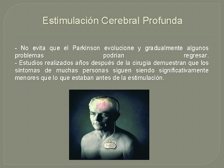 Estimulación Cerebral Profunda - No evita que el Parkinson evolucione y gradualmente algunos problemas