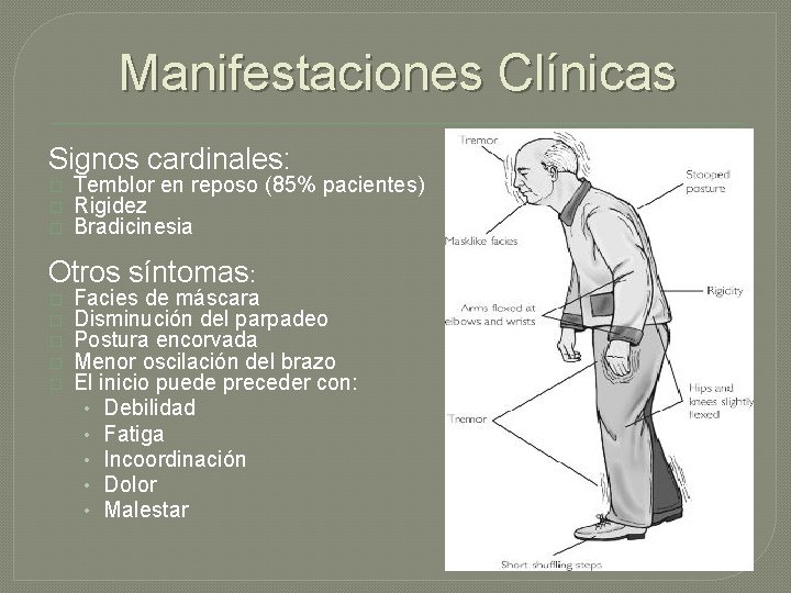 Manifestaciones Clínicas Signos cardinales: � � � Temblor en reposo (85% pacientes) Rigidez Bradicinesia