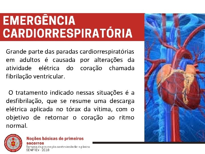 Grande parte das paradas cardiorrespiratórias em adultos é causada por alterações da atividade elétrica