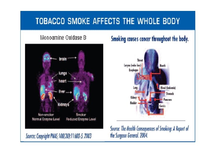 Tobacco and health effects 