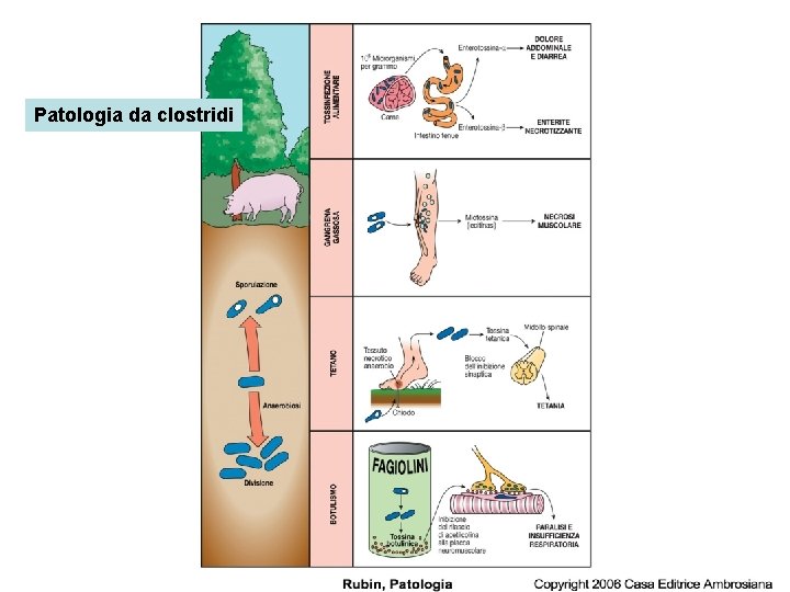 Patologia da clostridi 