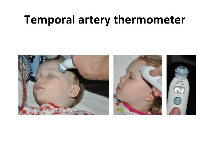 Temporal artery thermometer 