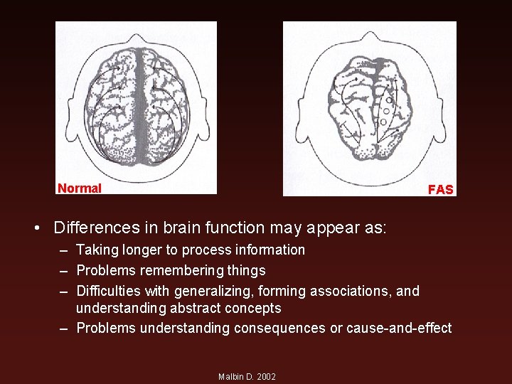 Normal FAS • Differences in brain function may appear as: – Taking longer to