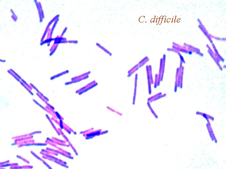 C. difficile 