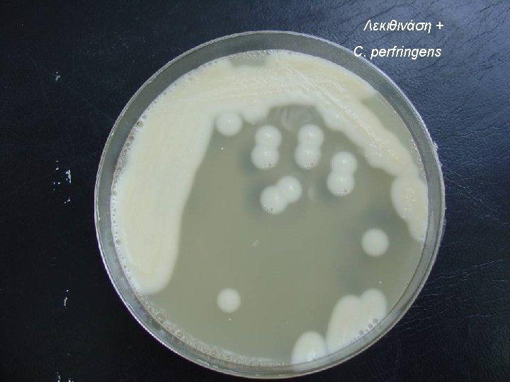 Λεκιθινάση + C. perfringens 