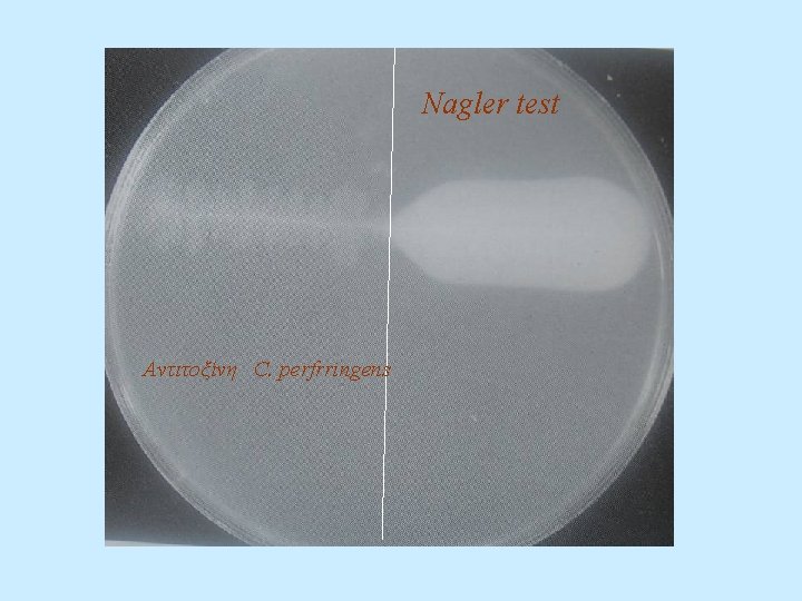 Nagler test Αντιτοξίνη C. perfrringens 