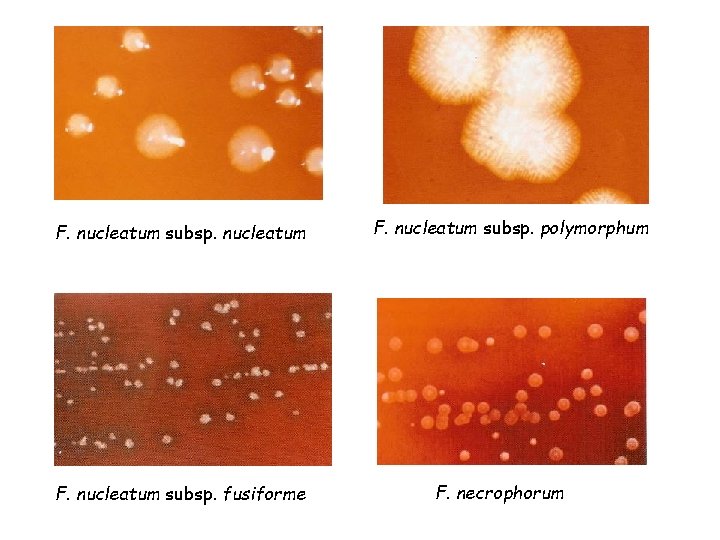 F. nucleatum subsp. nucleatum F. nucleatum subsp. fusiforme F. nucleatum subsp. polymorphum F. necrophorum