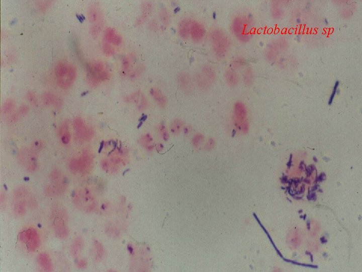 Lactobacillus sp 