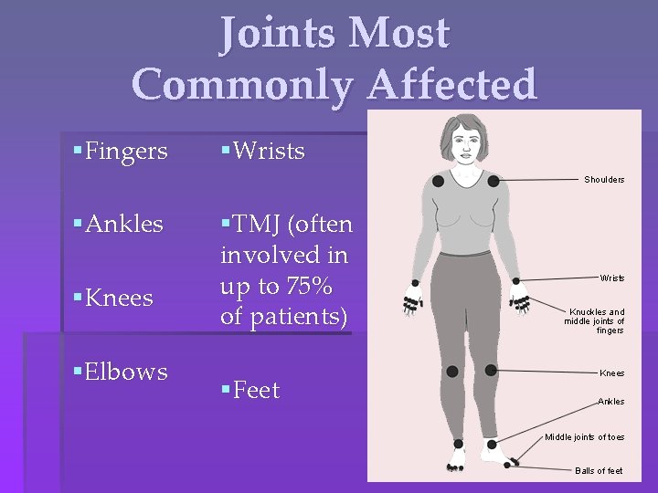 Joints Most Commonly Affected §Fingers §Wrists §Ankles §TMJ (often involved in up to 75%