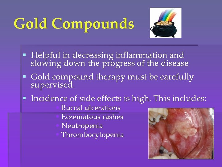 Gold Compounds § Helpful in decreasing inflammation and slowing down the progress of the