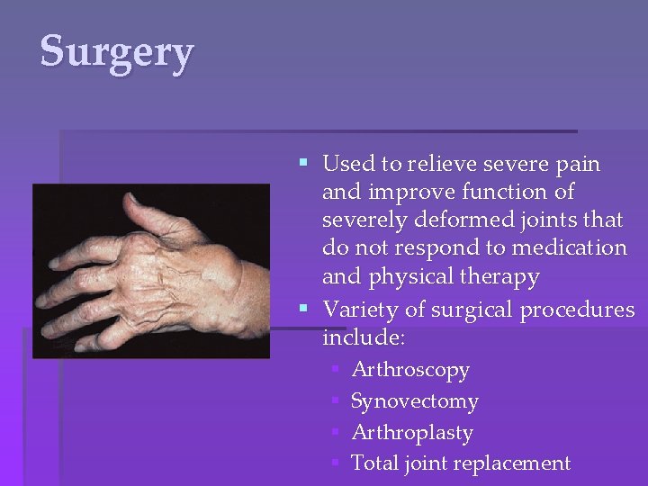 Surgery § Used to relieve severe pain and improve function of severely deformed joints