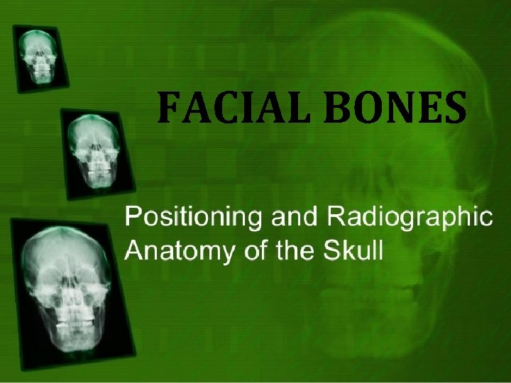 FACIAL BONES 
