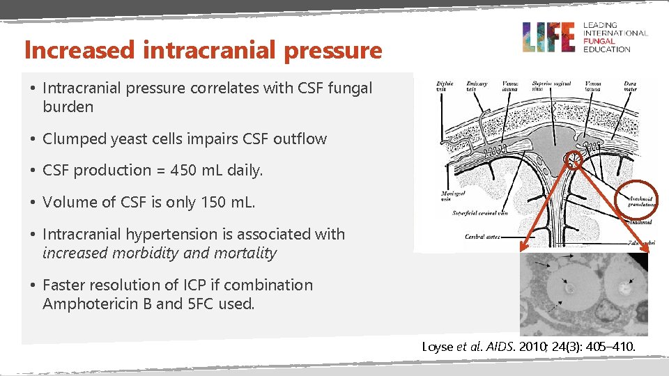 Increased intracranial pressure • Intracranial pressure correlates with CSF fungal burden • Clumped yeast