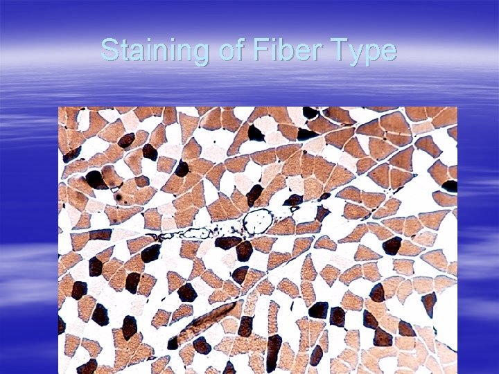 Staining of Fiber Type 