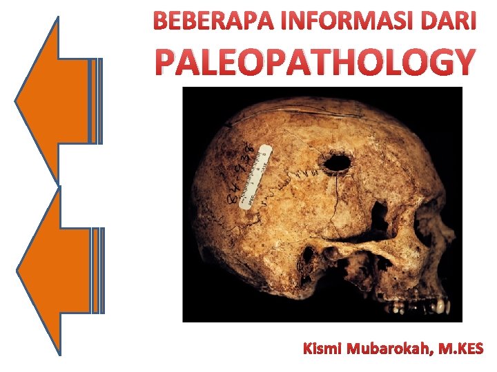 BEBERAPA INFORMASI DARI PALEOPATHOLOGY Kismi Mubarokah, M. KES 