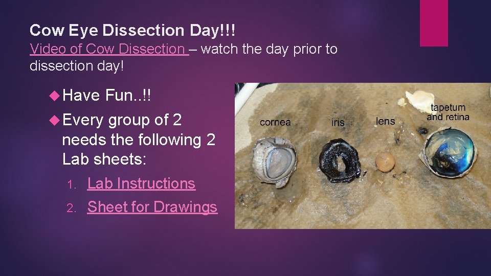 Cow Eye Dissection Day!!! Video of Cow Dissection – watch the day prior to Cow Eye Dissection Day!!! Video of Cow Dissection – watch the day prior to
