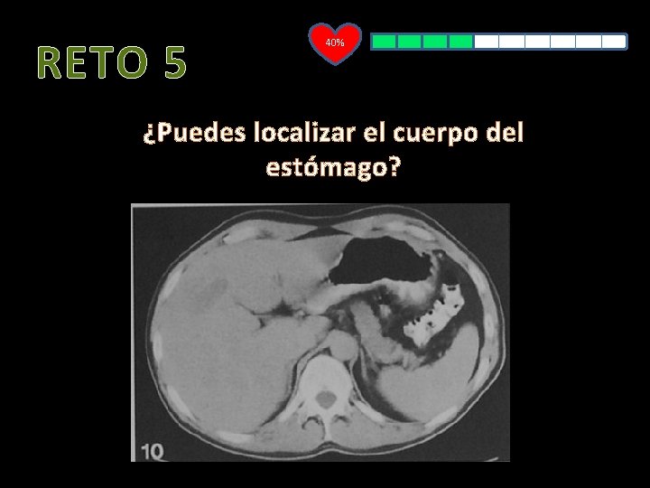 RETO 5 40% ¿Puedes localizar el cuerpo del estómago? 