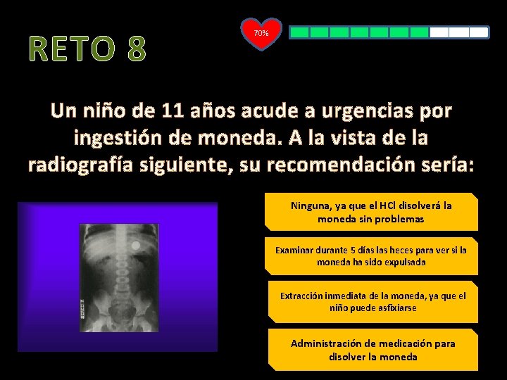 RETO 8 70% Un niño de 11 años acude a urgencias por ingestión de