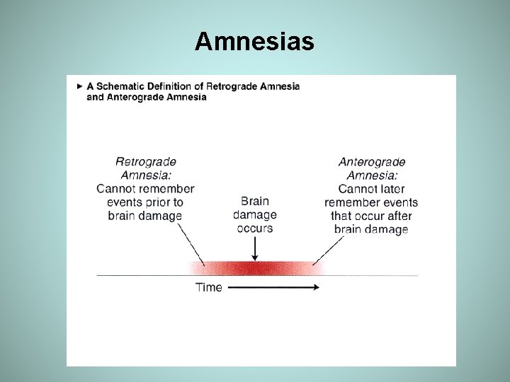 Amnesias 