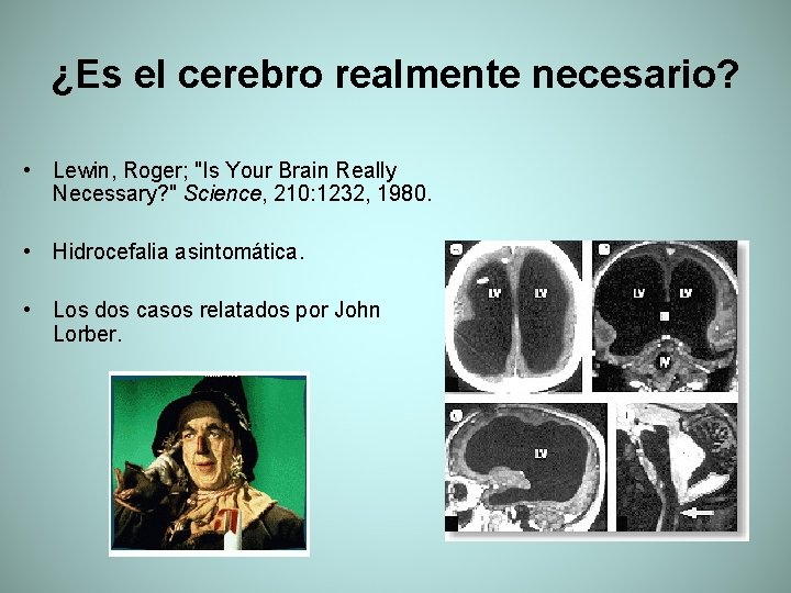 ¿Es el cerebro realmente necesario? • Lewin, Roger; "Is Your Brain Really Necessary? "