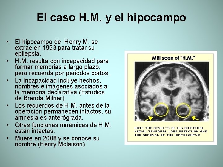 El caso H. M. y el hipocampo • El hipocampo de Henry M. se