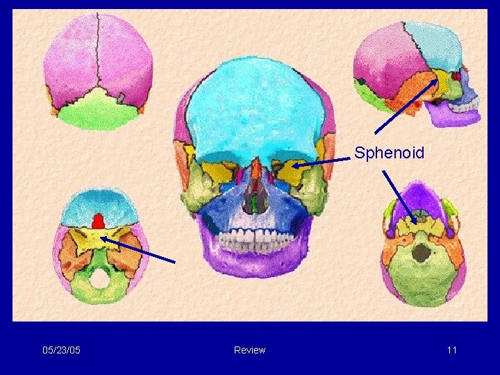 Sphenoid 05/23/05 Review 11 