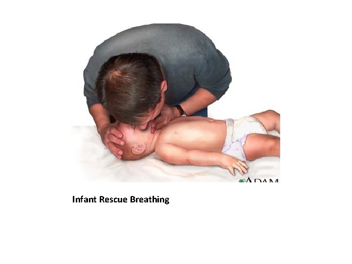 Infant Rescue Breathing 