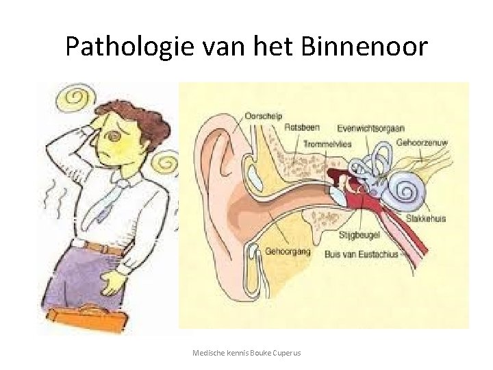 Pathologie van het Binnenoor Medische kennis Bouke Cuperus 