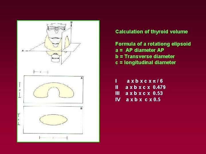 Calculation of thyroid volume Formula of a rotationg elipsoid a = AP diameter AP