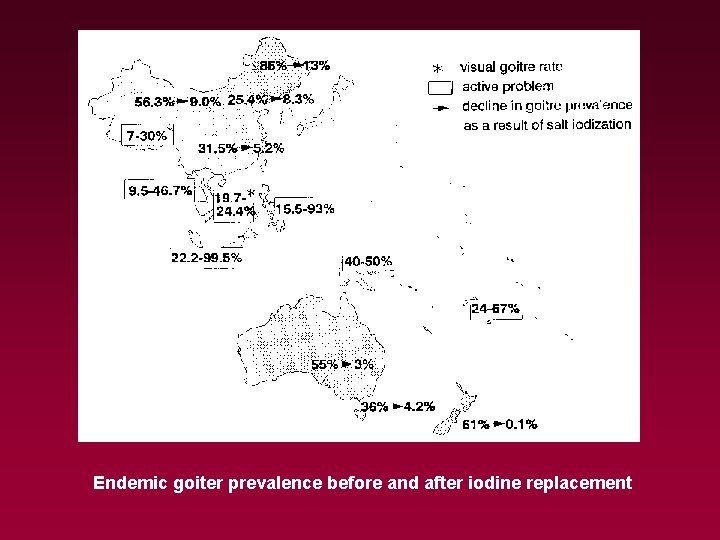 Endemic goiter prevalence before and after iodine replacement 