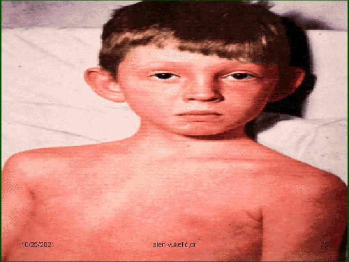 10/25/2021 alen vukelić, dr 25 