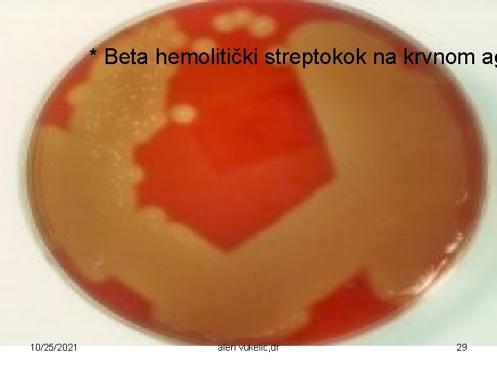 * Beta hemolitički streptokok na krvnom ag 10/25/2021 alen vukelić, dr 29 