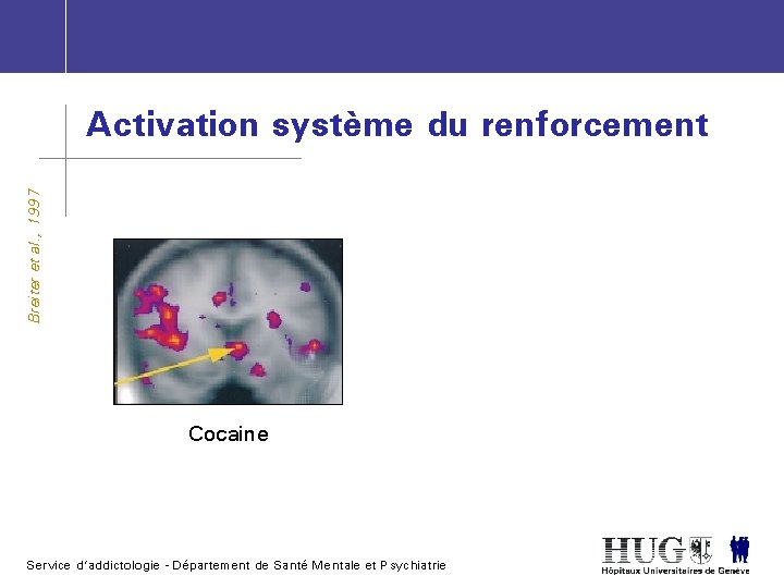 Breiter et al. , 1997 Activation système du renforcement Cocaine Service d’addictologie - Département