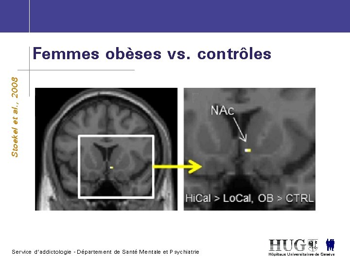 Stoekel et al. , 2008 Femmes obèses vs. contrôles Service d’addictologie - Département de