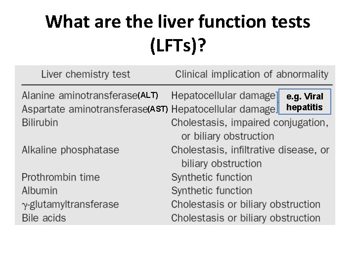 What are the liver function tests (LFTs)? (ALT) (AST) e. g. Viral hepatitis 