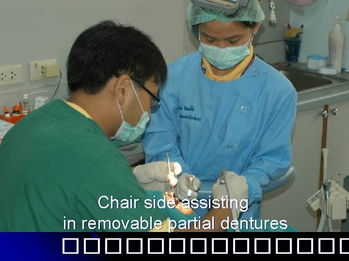 Chair side assisting in removable partial dentures ������� 