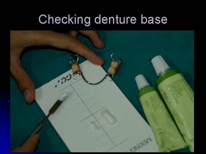 Checking denture base 