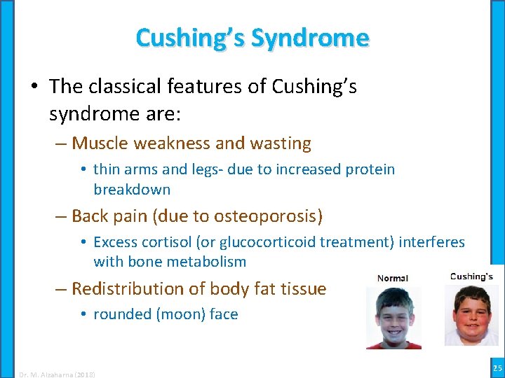Cushing’s Syndrome • The classical features of Cushing’s syndrome are: – Muscle weakness and