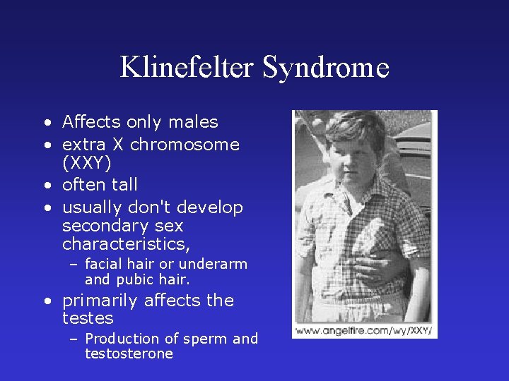 Klinefelter Syndrome • Affects only males • extra X chromosome (XXY) • often tall Klinefelter Syndrome • Affects only males • extra X chromosome (XXY) • often tall