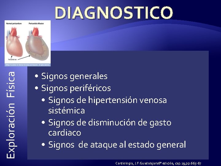 Exploración Física DIAGNOSTICO • Signos generales • Signos periféricos • Signos de hipertensión venosa