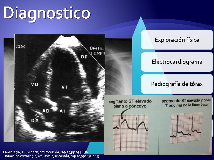 Diagnostico Exploración física Electrocardiograma Radiografía de tórax Ecocardiograma biomarcadores cardiacos (troponina y/o CKMB) Cardiologia,