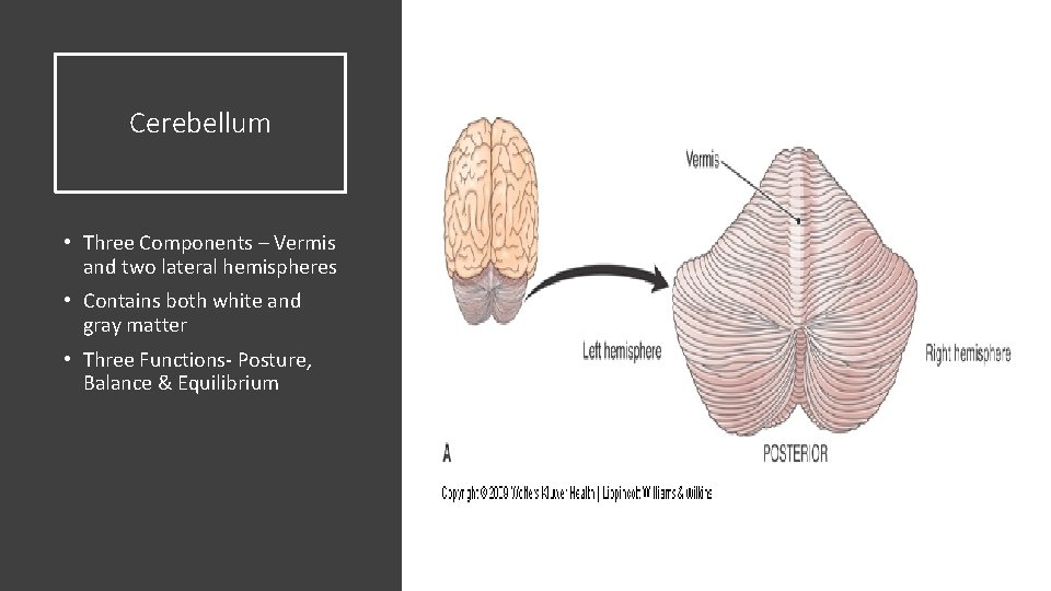 Cerebellum • Three Components – Vermis and two lateral hemispheres • Contains both white Cerebellum • Three Components – Vermis and two lateral hemispheres • Contains both white