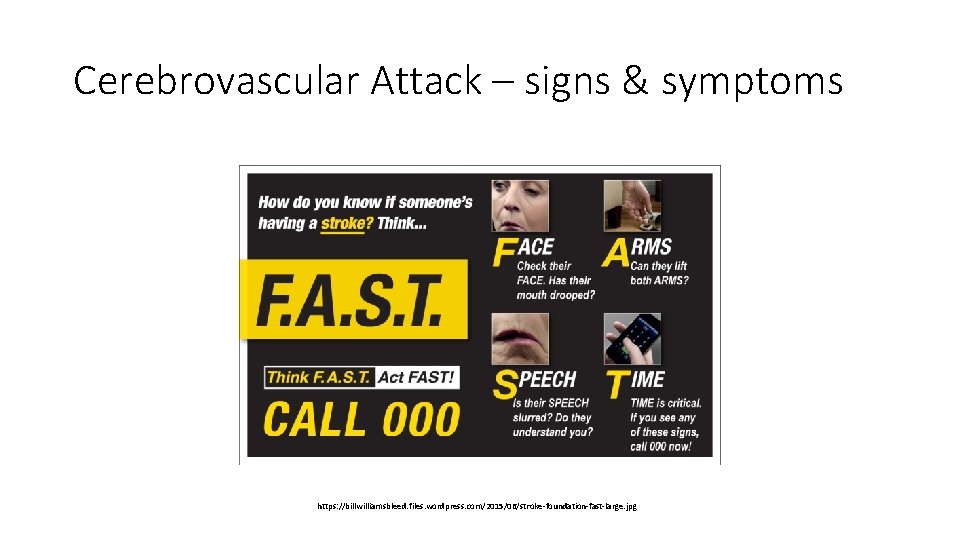 Cerebrovascular Attack – signs & symptoms https: //billwilliamsbleed. files. wordpress. com/2015/06/stroke-foundation-fast-large. jpg Cerebrovascular Attack – signs & symptoms https: //billwilliamsbleed. files. wordpress. com/2015/06/stroke-foundation-fast-large. jpg